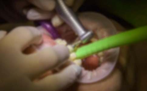 老虎拔牙童話作文