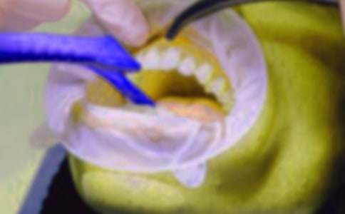 有關拔牙作文500字4篇