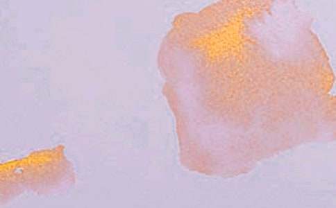 �����]��ˇ�g�����\��4ƪ